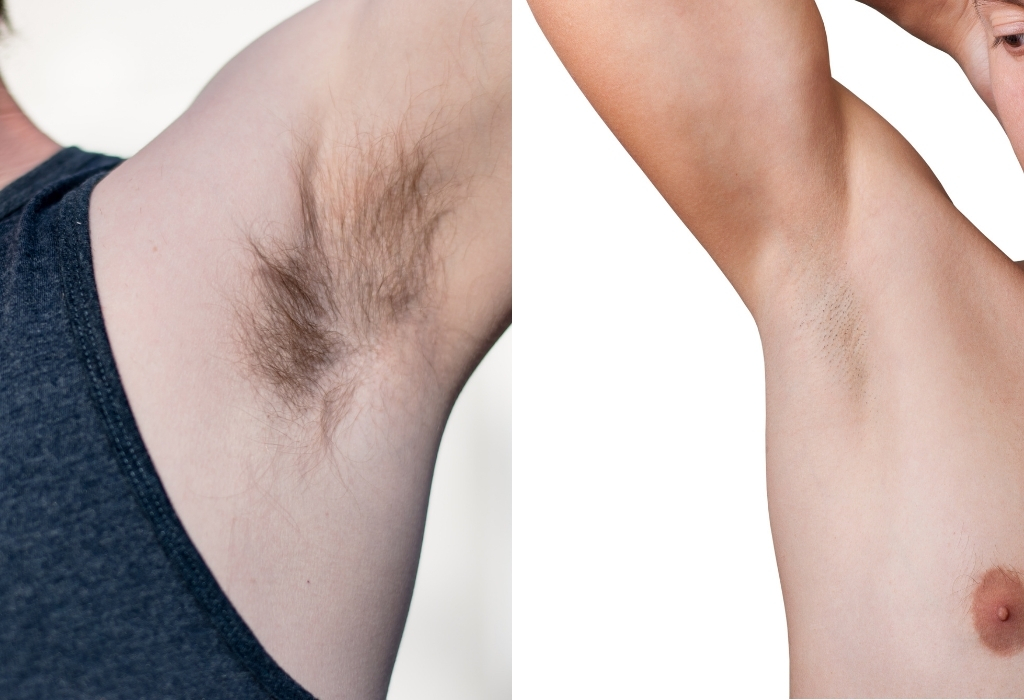 should men shave armpits - Armpit Shaved vs. Hairy