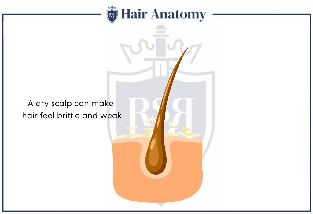 dry scalp infographic