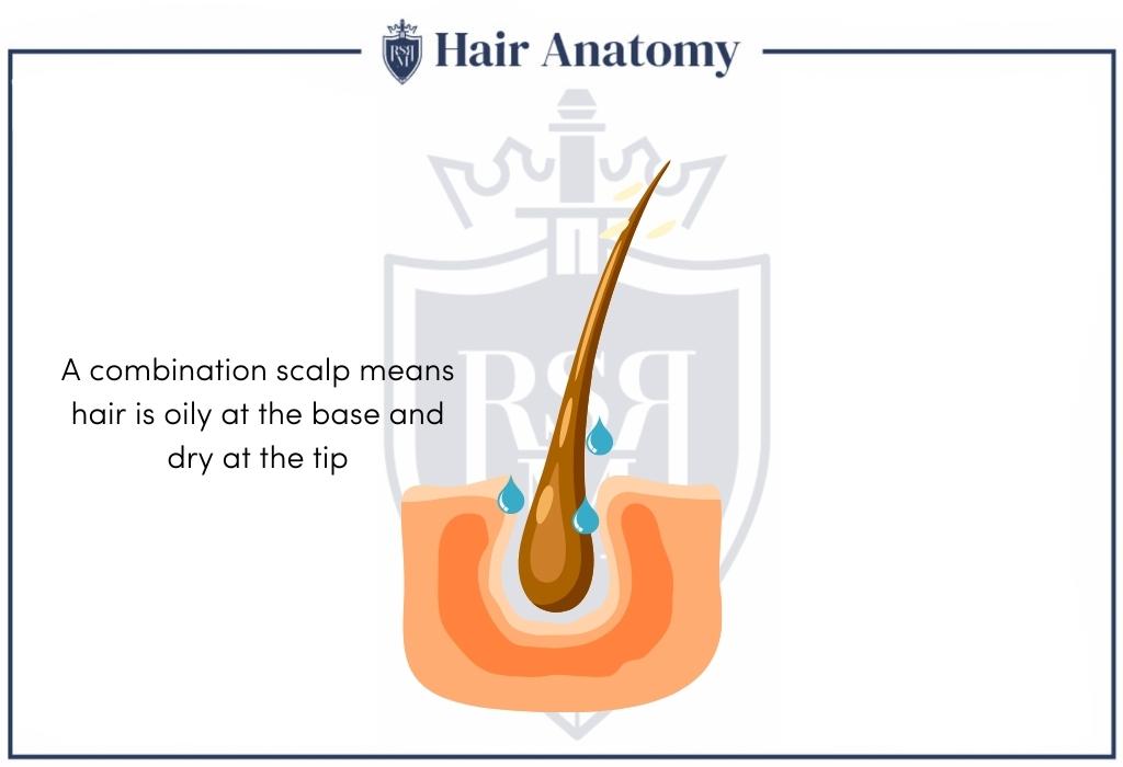 combination scalp infographic